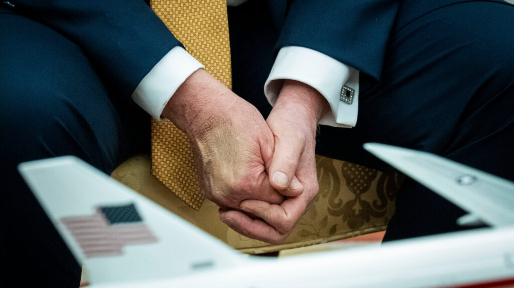 Chronic Venous Insufficiency Diagnosis: How Serious Is Trump’s Condition?