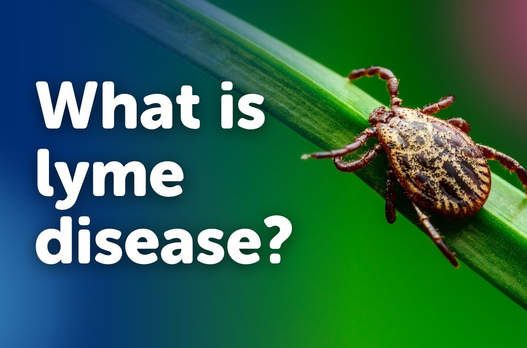 Lyme Disease