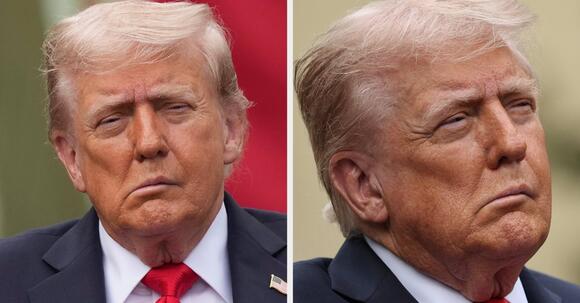 What’s Wrong with Donald Trump’s Face? Public Speculation After 9/11 Memorial Appearance